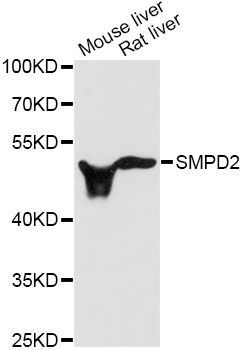 Western blot - SMPD2 antibody (144-60072)