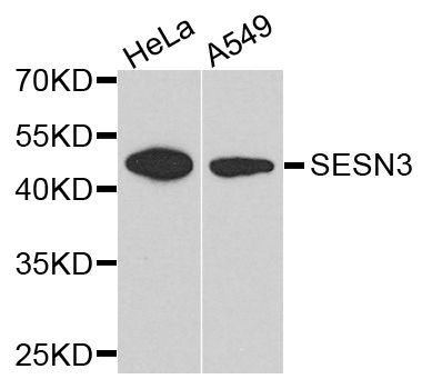 Western blot - SESN3 antibody (144-05164)