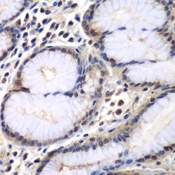 Immunohistochemistry - PSMB2 antibody (144-013630)