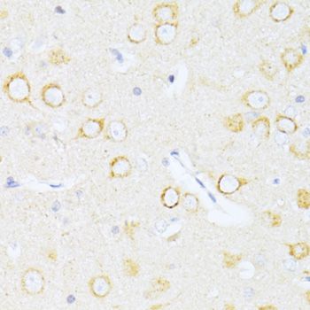 Immunohistochemistry - Casp8 antibody (144-011324)