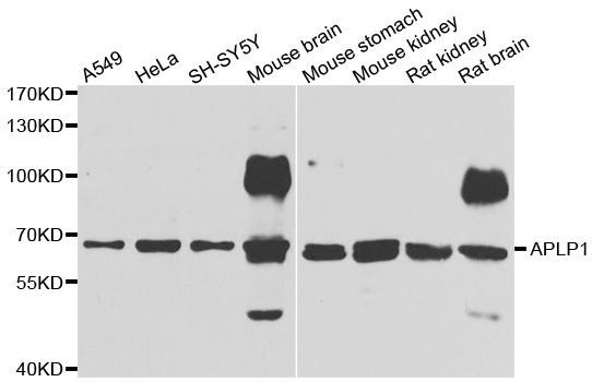 Western blot - APLP1 Polyclonal Antibody (144-06870)