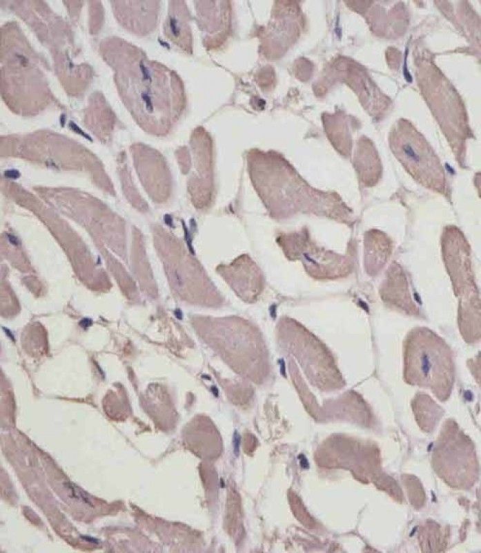 IHC-P