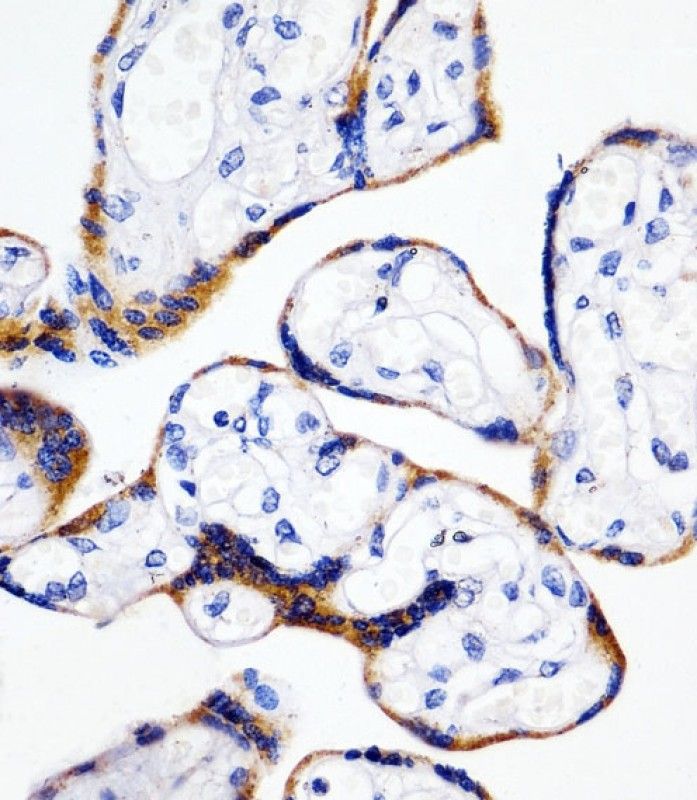IHC-P