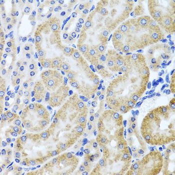 Immunohistochemistry - HDAC6 antibody (144-01732)