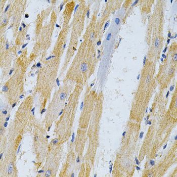 Immunohistochemistry - [KO Validated] ADRBK1 Polyclonal Antibody (144-01662)