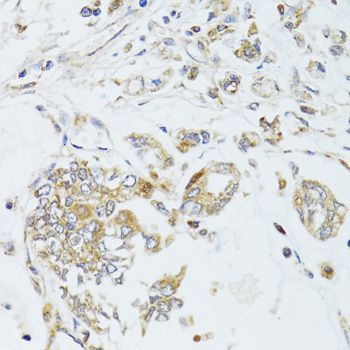Immunohistochemistry - MAD2L2 antibody (144-09861)