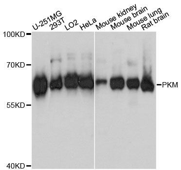 Western blot - PKM antibody (144-013905)
