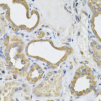 Immunohistochemistry - ICOSLG Polyclonal Antibody (144-07080)
