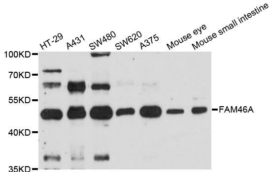 Western blot - FAM46A antibody (144-12765)