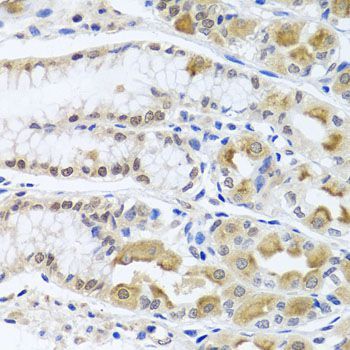 Immunohistochemistry - TRMT1 antibody (144-07116)