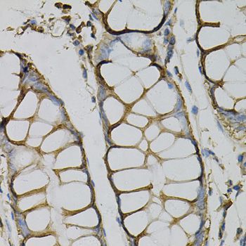 Immunohistochemistry - AZGP1 Polyclonal Antibody (144-61415)