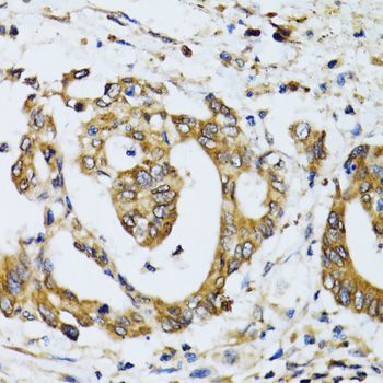 Immunohistochemistry - RPN1 antibody (144-600827)