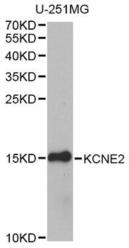 Western blot - KCNE2 antibody (144-09859)