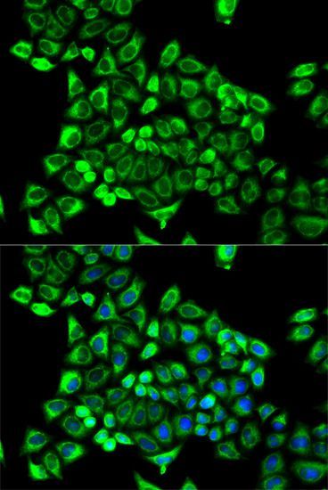 Immunofluorescence - CDA antibody (144-02006)