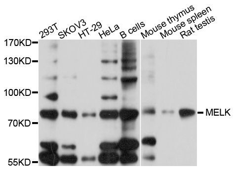 Western blot - MELK Polyclonal Antibody (144-10794)
