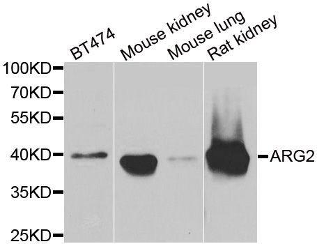 Western blot - ARG2 antibody (144-06355)