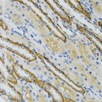 Immunohistochemistry - COG2 antibody (144-06251)