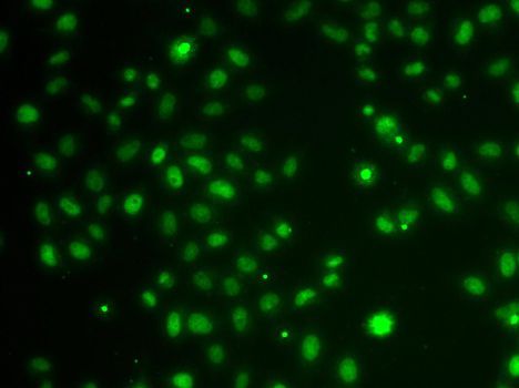 Immunofluorescence - POU6F1 Polyclonal Antibody (144-07299)