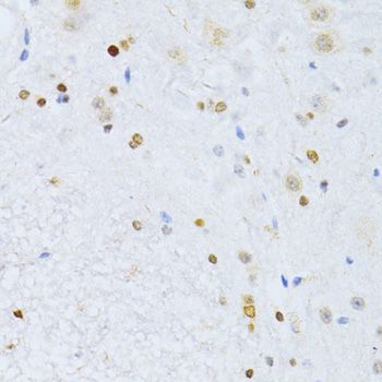 Immunohistochemistry - ZEB2 Polyclonal Antibody (144-05705)