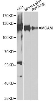 Western blot - MCAM antibody (144-60521)