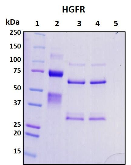 SDS-PAGE image