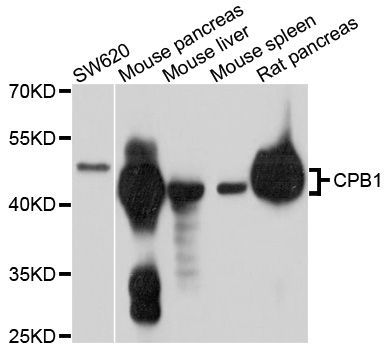 Western blot - CPB1 Polyclonal Antibody (144-600556)