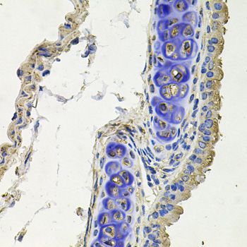 Immunohistochemistry - SKP1 antibody (144-02566)