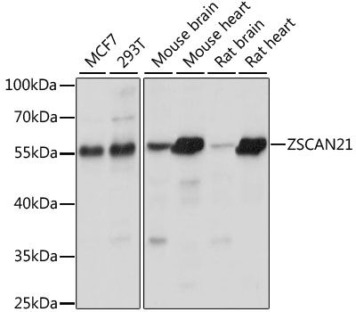 Western blot - ZSCAN21 antibody (144-60998)