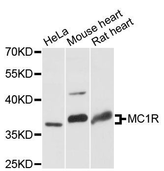 Western blot - MC1R antibody (144-60215)