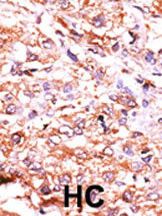 IHC-P