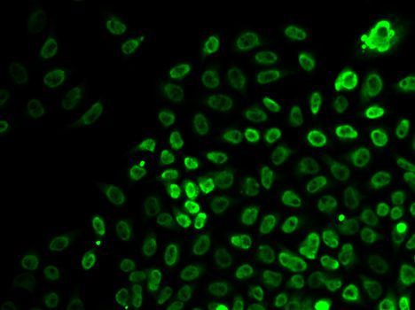 Immunohistochemistry - [KO Validated] SMARCA4 Polyclonal Antibody (144-00887)