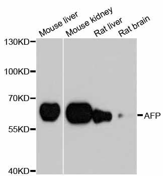 Western blot - AFP Polyclonal Antibody (144-00200)