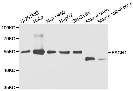 Western blot - [KO Validated] FSCN1 Polyclonal Antibody (144-01904)