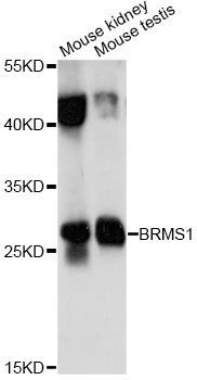 Western blot - BRMS1 Polyclonal Antibody (144-014865)