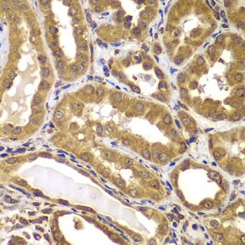 Immunohistochemistry - PSEN2 Polyclonal Antibody (144-07719)