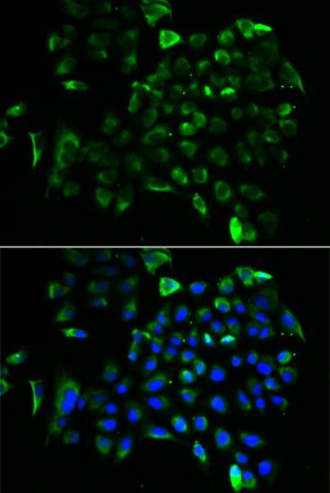 Immunohistochemistry - [KO Validated] EEF1B2 Polyclonal Antibody (144-06580)