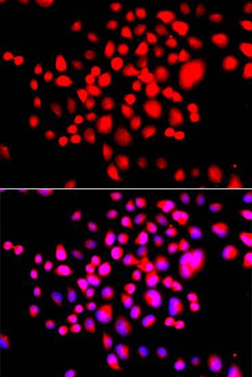 Immunofluorescence - STK19 antibody (144-013383)