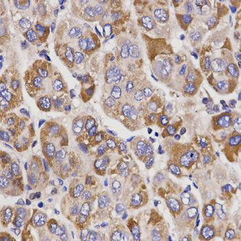 Immunohistochemistry - UGT1A9 antibody (144-01661)