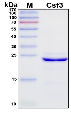 SDS-PAGE Image