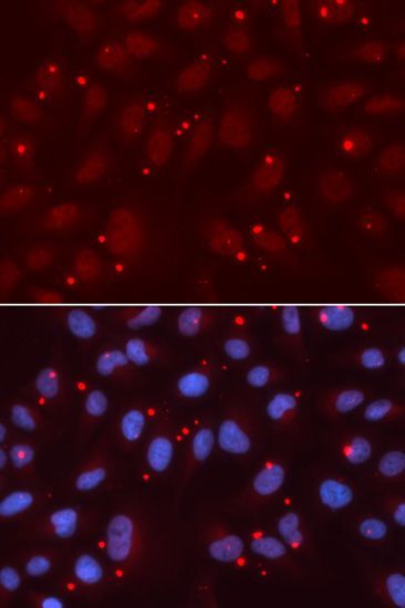 Immunofluorescence - XRCC3 antibody (144-02134)