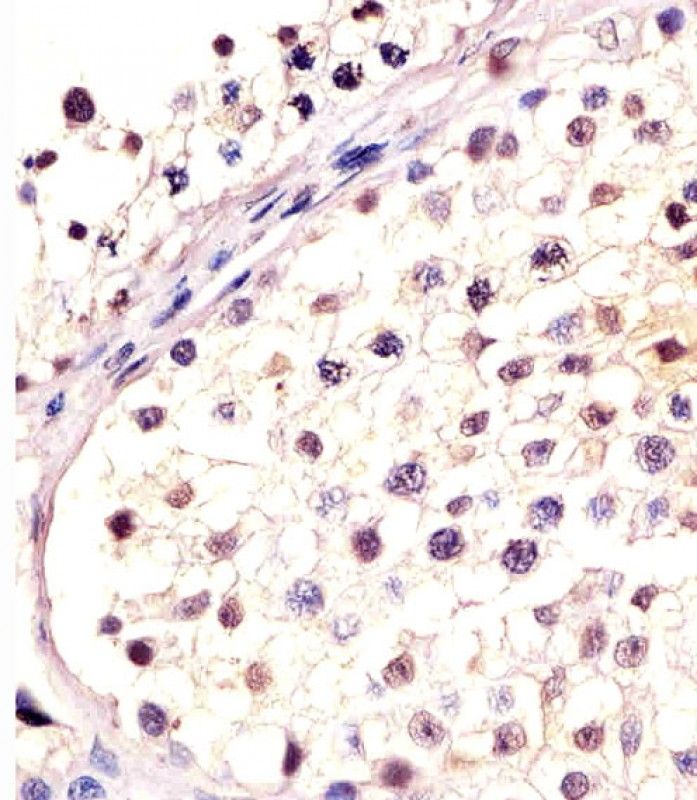IHC-P