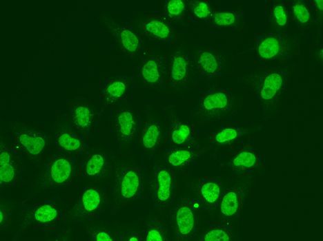 Immunofluorescence - POLR2J Polyclonal Antibody (144-01843)