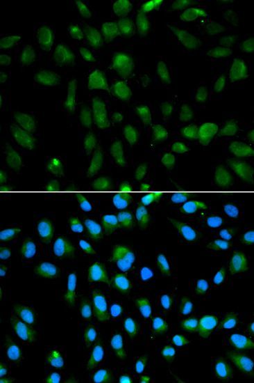 Western blot - PSMA3 Polyclonal Antibody (144-01245)
