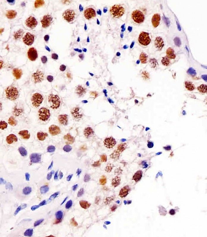 IHC-P