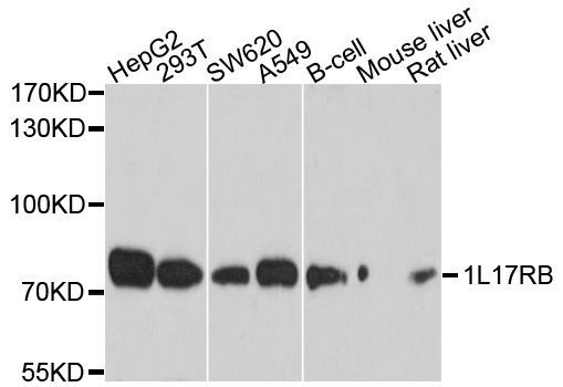 Western blot - IL17RB Polyclonal Antibody (144-010147)