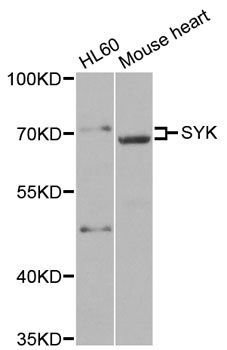 Western blot - SYK antibody (144-02123)