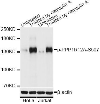 Western blot - Phospho-PPP1R12A-S507 pAb (144-61513)