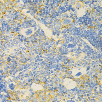 Immunohistochemistry - GPX4 Antibody (144-01933)