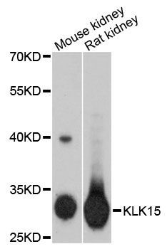 Western blot - KLK15 antibody (144-61351)