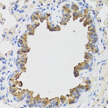 Immunohistochemistry - B9D1 antibody (144-07973)